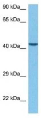 Western Blot: BMP-3 Antibody [NBP3-10785] - Western blot analysis of BMP-3 in Human MCF7 Whole Cell. Antibody dilution at 1 ug/mL