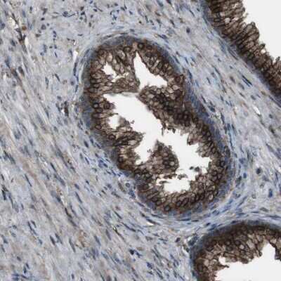 Immunohistochemistry-Paraffin: BMP-3b/GDF-10 Antibody [NBP1-88574] - Staining of human prostate shows strong cytoplasmic positivity in glandular cells.