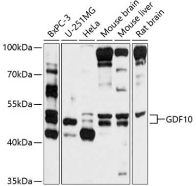 Western Blot: BMP-3b/GDF-10 Antibody [NBP2-92033] - Analysis of extracts of various cell lines, using BMP-3b/GDF-10 at 1:1000 dilution.Secondary antibody: HRP Goat Anti-Rabbit IgG (H+L) at 1:10000 dilution.Lysates/proteins: 25ug per lane.Blocking buffer: 3% nonfat dry milk in TBST.Detection: ECL Basic Kit .Exposure time: 10s.