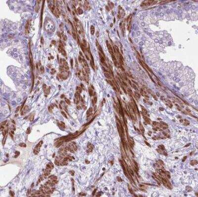 Immunohistochemistry-Paraffin: BMP-4 Antibody [NBP2-49477] - Staining of human prostate shows strong cytoplasmic postivity in smooth muscle cells.