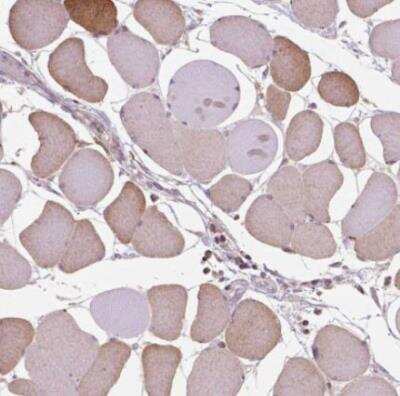 Immunohistochemistry-Paraffin: BMP-4 Antibody [NBP2-49477] - Staining of human skeletal muscle shows moderate ctyoplasmic positivity in myocytes.
