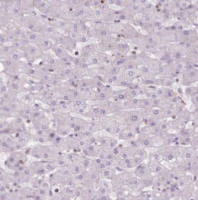 Immunohistochemistry-Paraffin: BMP-4 Antibody [NBP2-49477] - Staining of human liver shows no cytoplasmic positivity in hepatocytes as expected.