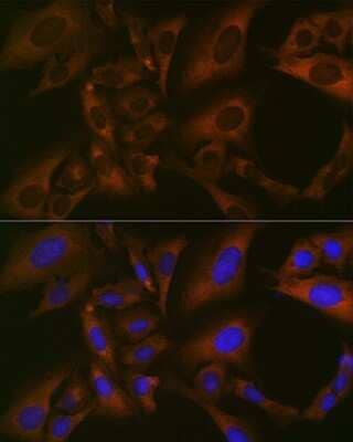 Immunocytochemistry/Immunofluorescence: BMP-6 Antibody (6N5S9) [NBP3-16430] - Immunofluorescence analysis of U-2 OS cells using BMP-6 Rabbit mAb (NBP3-16430) at dilution of 1:100 (40x lens). Blue: DAPI for nuclear staining.