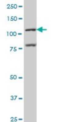Western Blot: BMP2K Antibody (1F11) [H00055589-M02] - BMP2K monoclonal antibody (M02), clone 1F11 Analysis of BMP2K expression in MCF-7.