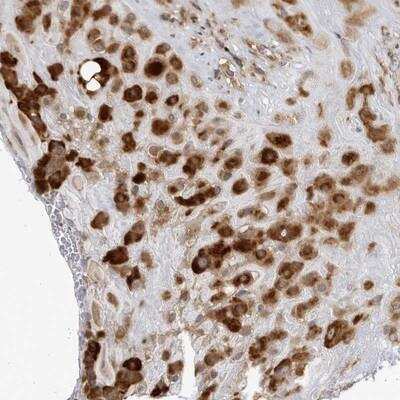 Immunohistochemistry: BMP2K Antibody [NBP1-88601] - Staining of human placenta shows strong cytoplasmic positivity in decidua cells.