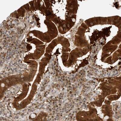 Immunohistochemistry-Paraffin: BMP2K Antibody [NBP1-88602] - Staining of human duodenum shows strong cytoplasmic and nuclear positivity in glandular cells.