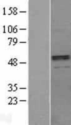 Western Blot: BMP3 Overexpression Lysate (Adult Normal) [NBL1-08001] Left-Empty vector transfected control cell lysate (HEK293 cell lysate); Right -Over-expression Lysate for BMP3.