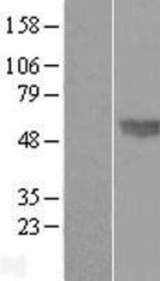 Western Blot: BMP4 Overexpression Lysate (Adult Normal) [NBP2-08225] Left-Empty vector transfected control cell lysate (HEK293 cell lysate); Right -Over-expression Lysate for BMP4.