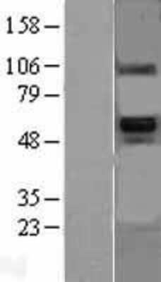 Western Blot: BMP6 Overexpression Lysate (Adult Normal) [NBL1-08005] Left-Empty vector transfected control cell lysate (HEK293 cell lysate); Right -Over-expression Lysate for BMP6.