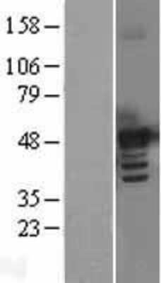 Western Blot: BMP7 Overexpression Lysate (Adult Normal) [NBL1-08006] Left-Empty vector transfected control cell lysate (HEK293 cell lysate); Right -Over-expression Lysate for BMP7.