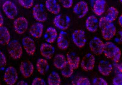 Immunocytochemistry/Immunofluorescence: BMPR-IA/ALK-3 Antibody [24960002] - Locolization of GAK-1 on chromosomes in C. elegans germline. Antibody dilution 1:400. Data provided by Jinmin Gao, Ph.D, Department of Genetics, Harvard Medical School.
