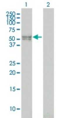 Western Blot: BMPR-IB/ALK-6 Antibody (3A8) [H00000658-M02] - Analysis of BMPR1B expression in transfected 293T cell line by BMPR1B monoclonal antibody (M02), clone 3A8.Lane 1: BMPR1B transfected lysate(57 KDa).Lane 2: Non-transfected lysate.