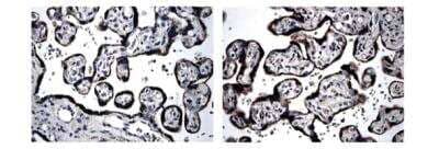 Immunohistochemistry-Paraffin: BMPR-IB/ALK-6 Antibody (MM0055-3E12) [NBP2-12031] - Human placenta (formalin fixed and paraffin embedded) section is subjected to IHC using MM0055-3E12