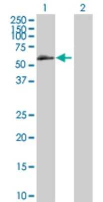 Western Blot: BMPR-IB/ALK-6 Antibody [H00000658-B01P] - Analysis of BMPR1B expression in transfected 293T cell line by BMPR1B polyclonal antibody.  Lane 1: BMPR1B transfected lysate(55.22 KDa). Lane 2: Non-transfected lysate.