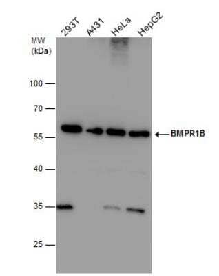 Western Blot: BMPR-IB/ALK-6 Antibody [NBP2-14889] -  Various whole cell extracts (30 ug) were separated by 10% SDS-PAGE, and the membrane was blotted with BMPR1B antibody diluted at 1:1000.