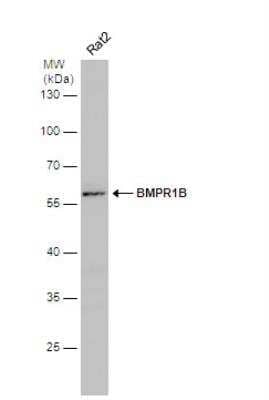 Western Blot: BMPR-IB/ALK-6 Antibody [NBP2-14889] - Whole cell extract (30 ug) was separated by 10% SDS-PAGE, and the membrane was blotted with BMPR1B antibody [N3C3] diluted at 1:1000.