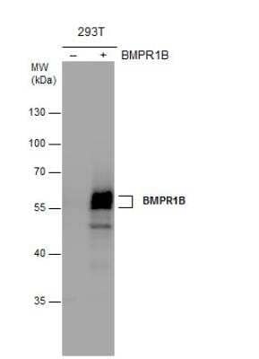 Western Blot: BMPR-IB/ALK-6 Antibody [NBP2-14889] - Non-transfected (-) and BMPR1B-transfected (+, ) 293T whole cell extracts (30 ug) were separated by 10% SDS-PAGE, and the membrane was blotted with BMPR1B antibody at a dilution of 1:5000.