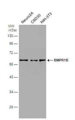 Western Blot: BMPR-IB/ALK-6 Antibody [NBP2-14889] - Various whole cell extracts (30 ug) were separated by 10% SDS-PAGE, and the membrane was blotted with BMPR1B antibody [N3C3] diluted at 1:1000.