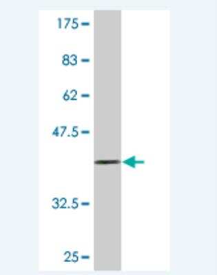Western Blot: BMPR-II Antibody (2C10) [H00000659-M02] -  Detection against Immunogen (36.63 KDa) .