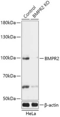 Knockout Validated: BMPR-II Antibody [NBP3-03627] - Analysis of extracts from normal (control) and BMPR2 knockout (KO) HeLa cells, using BMPR-II antibody at 1:1000 dilution. Secondary antibody: HRP Goat Anti-Rabbit IgG (H+L) at 1:10000 dilution. Lysates/proteins: 25ug per lane. Blocking buffer: 3% nonfat dry milk in TBST.