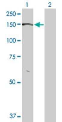 Western Blot: BMPR-II Antibody [H00000659-D01P] - Analysis of BMPR2 expression in transfected 293T cell line by BMPR2 polyclonal antibody.Lane 1: BMPR2 transfected lysate(115.20 KDa).Lane 2: Non-transfected lysate.