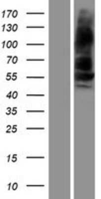 Western Blot: BMPR1B Overexpression Lysate (Adult Normal) [NBP2-08226] Left-Empty vector transfected control cell lysate (HEK293 cell lysate); Right -Over-expression Lysate for BMPR1B.