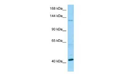 Western Blot: BMS1 Antibody [NBP2-82764] - WB Suggested Anti-BMS1 Antibody. Titration: 1.0 ug/ml. Positive Control: Fetal Kidney