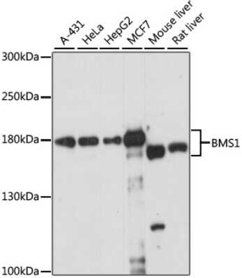 Western Blot: BMS1 Antibody [NBP2-92629] - Analysis of extracts of various cell lines, using BMS1 .Exposure time: 15s.
