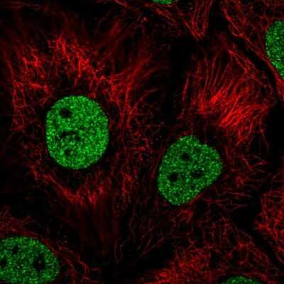 Immunocytochemistry/Immunofluorescence: BNC1 Antibody [NBP2-55855] - Staining of human cell line HaCaT shows localization to nucleoplasm. Antibody staining is shown in green.