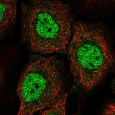 Immunocytochemistry/Immunofluorescence: BNC1 Antibody [NBP2-57360] - Staining of human cell line HaCaT shows localization to nucleoplasm.