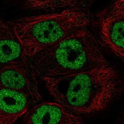 Immunocytochemistry/Immunofluorescence: BNC1 Antibody [NBP2-69039] - Staining of human cell line HaCaT shows localization to nucleoplasm.