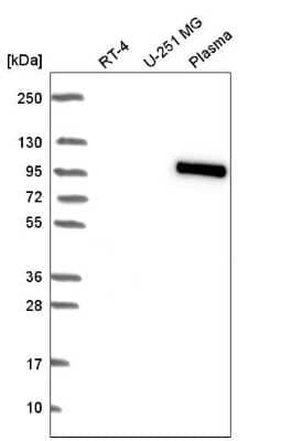 Western Blot: BNC1 Antibody [NBP2-57360] - Western blot analysis in human cell line RT-4, human cell line U-251 MG and human plasma.