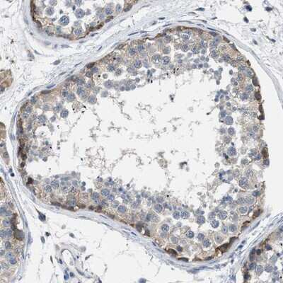 Immunohistochemistry-Paraffin: BNC2 Antibody [NBP1-88501] - Staining of human testis shows distinct positivity in basal cells of ductus seminiferus.