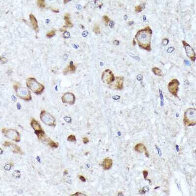 Immunohistochemistry-Paraffin: BNIP1 Antibody (10K6T9) [NBP3-16403] - Immunohistochemistry of paraffin-embedded rat brain using BNIP1 Rabbit mAb (NBP3-16403) at dilution of 1:100 (40x lens).Perform microwave antigen retrieval with 10 mM Tris/EDTA buffer pH 9.0 before commencing with IHC staining protocol.