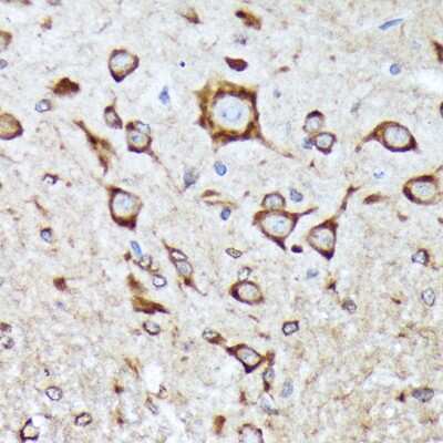 Immunohistochemistry-Paraffin: BNIP1 Antibody (10K6T9) [NBP3-16403] - Immunohistochemistry of paraffin-embedded mouse spinal cord using BNIP1 Rabbit mAb (NBP3-16403) at dilution of 1:100 (40x lens).Perform microwave antigen retrieval with 10 mM Tris/EDTA buffer pH 9.0 before commencing with IHC staining protocol.