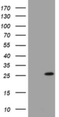 Western Blot: BNIP1 Antibody (OTI2B3) - Azide and BSA Free [NBP2-70257] - Analysis of HEK293T cells were transfected with the pCMV6-ENTRY control (Left lane) or pCMV6-ENTRY BNIP1.