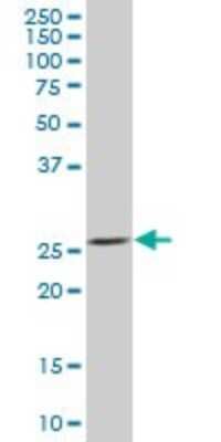 Western Blot: BNIP1 Antibody [H00000662-B01P] - Analysis of BNIP1 expression in human pancreas.