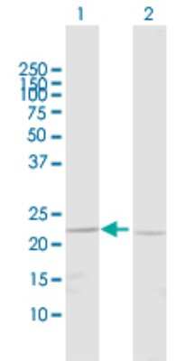 Western Blot: BNIP1 Antibody [H00000662-D01P] - Analysis of BNIP1 expression in transfected 293T cell line by BNIP1 polyclonal antibody.Lane 1: BNIP1 transfected lysate(22.40 KDa).Lane 2: Non-transfected lysate.