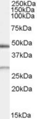 Western Blot: BNIP1 Antibody [NB100-68161] - (0.5ug/ml) staining of Human Kidney lysate (35ug protein in RIPA buffer). Primary incubation was 1 hour. Detected by chemiluminescence.