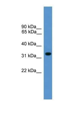 Western Blot: BNIP1 Antibody [NBP1-69182] - Titration: 0.2-1 ug/ml, Positive Control: Human Liver.