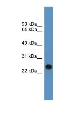 Western Blot: BNIP1 Antibody [NBP1-69183] - Titration: 0.2-1 ug/ml, Positive Control: Human Liver.