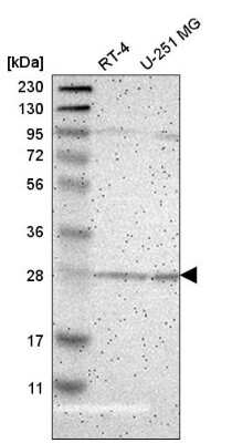 Western Blot: BNIP1 Antibody [NBP2-58913] - Western blot analysis in human cell line RT-4 and human cell line U-251 MG.