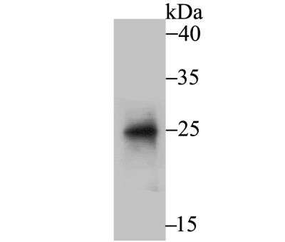 Western Blot: BNIP1 Antibody [NBP2-89153] - Analysis of BNIP1 on rat liver tissue lysate using anti-BNIP1 antibody at 1/500 dilution.