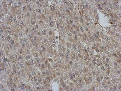 Immunohistochemistry-Paraffin: BNIP2 Antibody [NBP2-15602] - Immunohistochemical analysis of paraffin-embedded U87 xenograft, using antibody at 1:500 dilution.