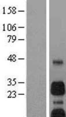 Western Blot BNIP3 Overexpression Lysate