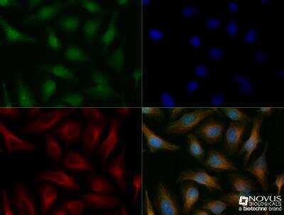 Immunocytochemistry/Immunofluorescence: BNIP3L Antibody [NBP1-78264] - HeLa cells were fixed for 10 minutes using 10% formalin and then permeabilized for 5 minutes using 1X TBS + 0.5% Triton-X100. The cells were incubated with anti-BNIP3L (NBP1-78264) at a 1:200 dilution overnight at 4C and detected with an anti-rabbit Dylight 488 (Green) at a 1:500 dilution. Alpha tubulin was used as a co-stain at a 1:1000 dilution and detected with and anti-mouse Dylight 550 (Red) at a 1:500 dilution. Nuclei were counterstained with DAPI (Blue). Cells were imaged using a 40X objective.