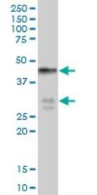 Western Blot: BNIPL Antibody [H00149428-B01P] - Analysis of BNIPL expression in human placenta.