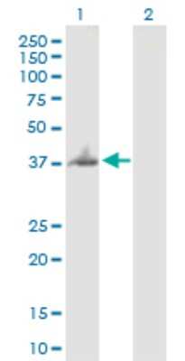 Western Blot: BNIPL Antibody [H00149428-B03P] - Analysis of BNIPL expression in transfected 293T cell line. Lane 1: BNIPL transfected lysate (31.00 KDa). Lane 2: Non-transfected lysate.