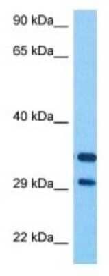 Western Blot: BNIPL Antibody [NBP3-10618] - Western blot analysis of BNIPL in Human Stomach Tumor lysates. Antibody dilution at 1ug/ml