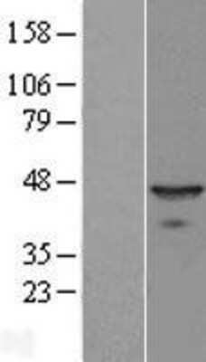 Western Blot: BNIPL Overexpression Lysate (Adult Normal) [NBL1-08016] Left-Empty vector transfected control cell lysate (HEK293 cell lysate); Right -Over-expression Lysate for BNIPL.